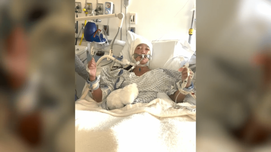 ‘This is unbelievable’: Young girl dances to Taylor Swift while in coma
